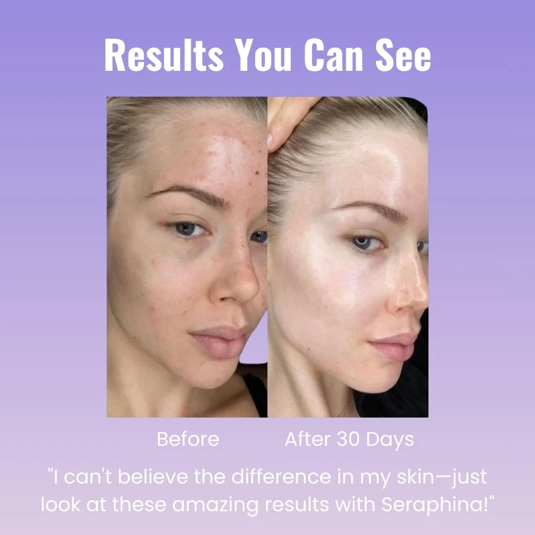 Seraphina™ 4-1 Skin Care Wand